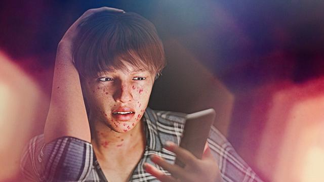 Eine Junge hat Pickel im Gesicht. Er schaut auf ein Smartphone.