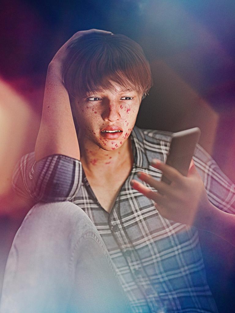 Eine Junge mit Akne starrt auf ein Smartphone.