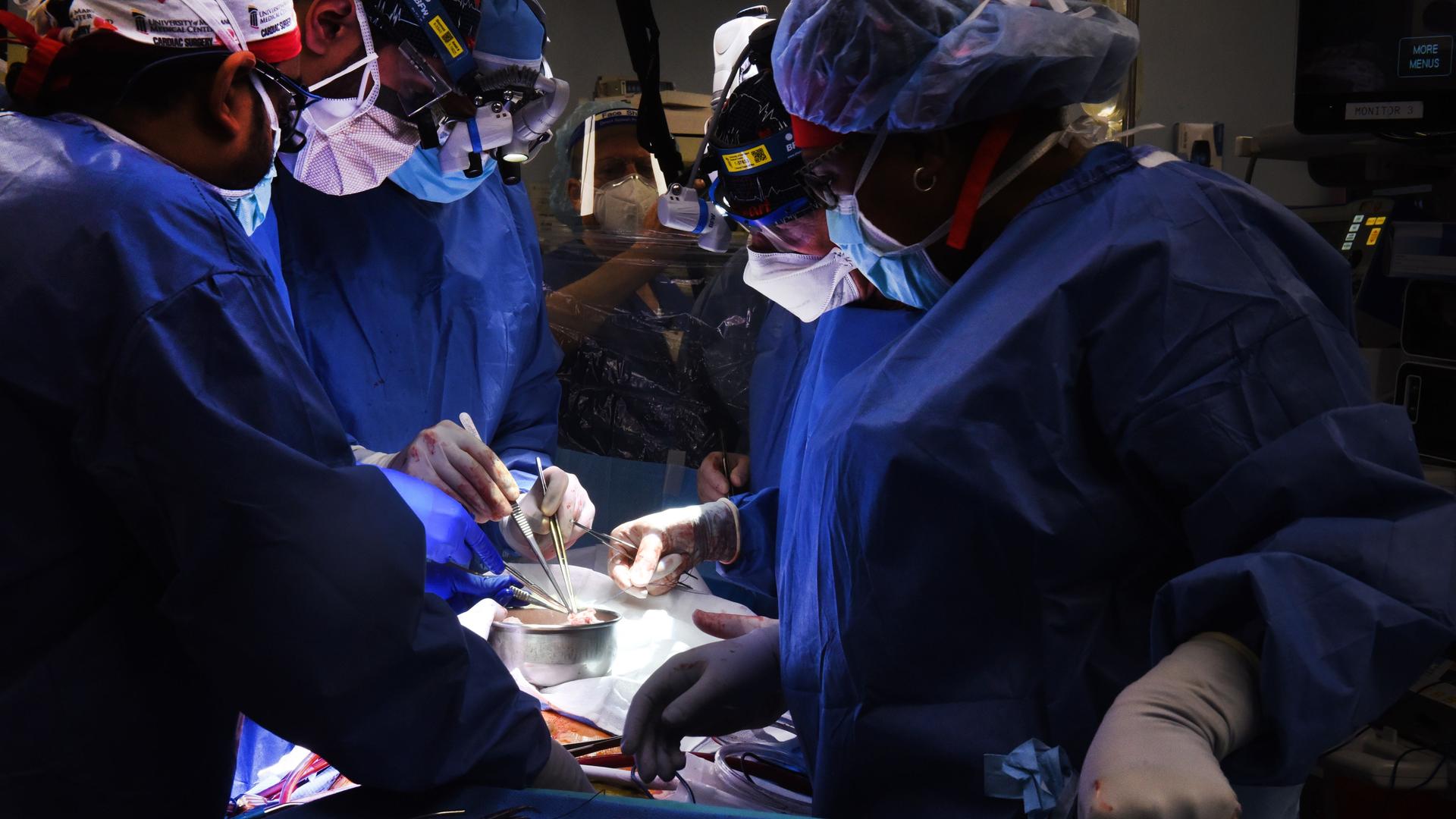 Auf diesem Foto, das von der University of Maryland School of Medicine zur Verfügung gestellt wurde, arbeitet ein Chirurgenteam daran, einem Patienten ein genmanipuliertes Schweineherz einzusetzen. 