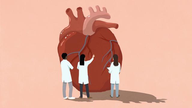 Eine Grafik mit einem Herz in der Mitte. Drei Menschen in weißen Kitteln stehen um das Herz und behandeln es. 