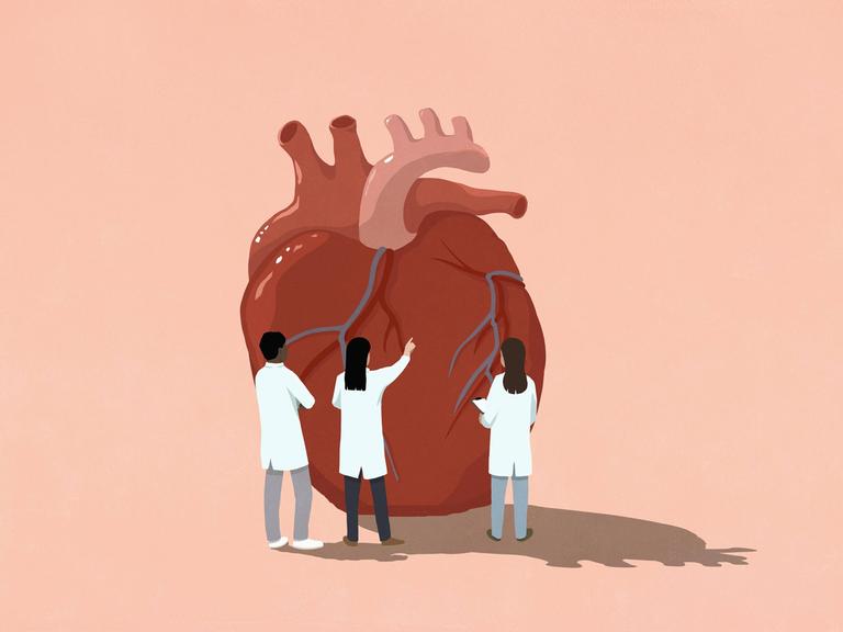 Eine Grafik mit einem Herz in der Mitte. Drei Menschen in weißen Kitteln stehen um das Herz und behandeln es. 
