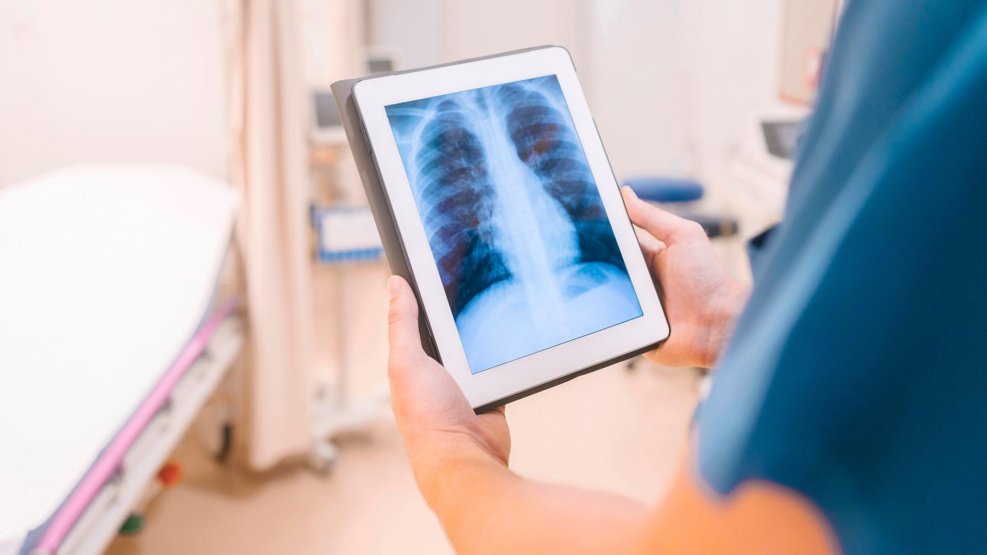 Eine Person hält ein Ipad auf dem ein Röntgenbild zu sehen ist