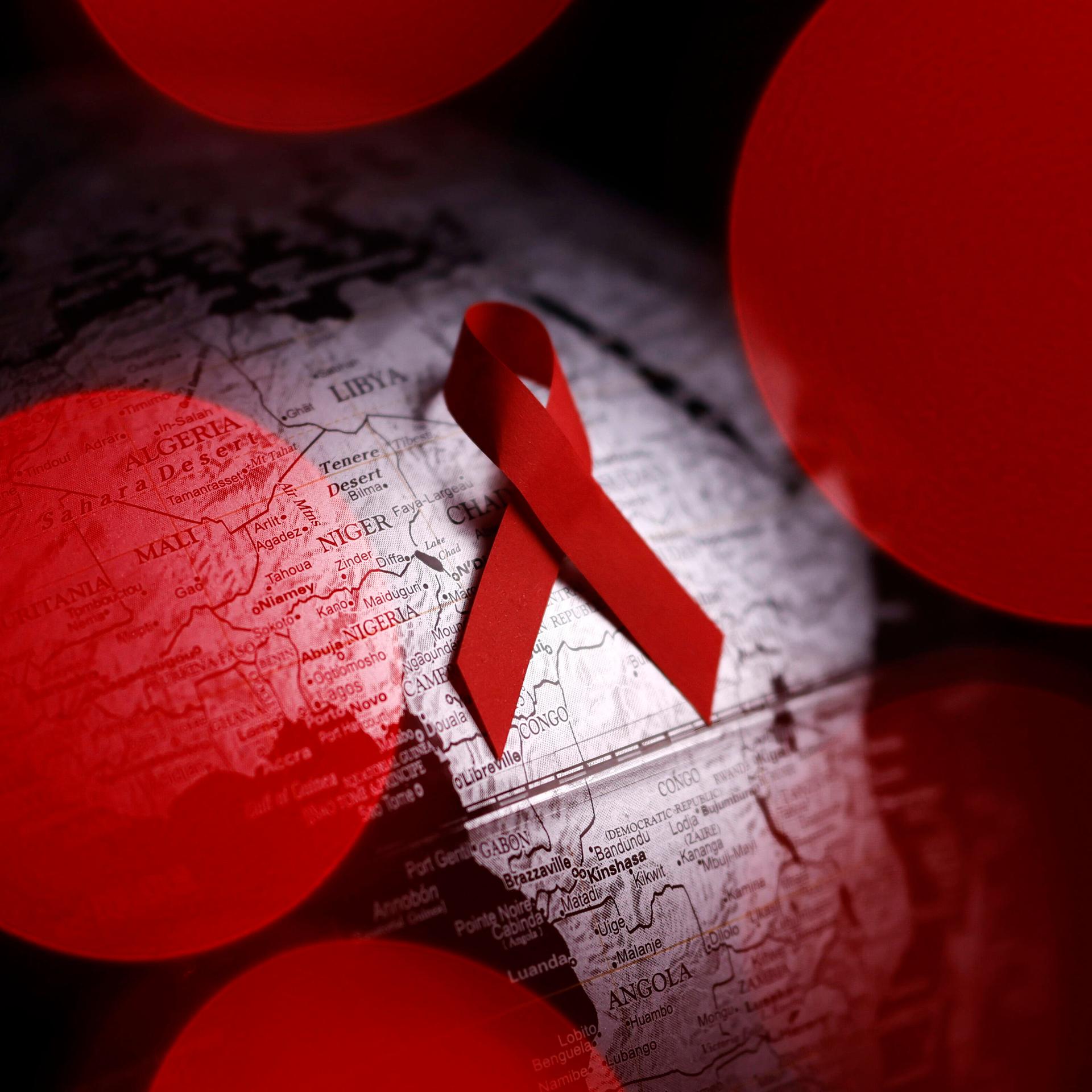 AIDS - Charité-Forscher machen weiter Hoffnung auf Heilung von HIV