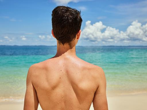 Eine Person mit einigen Muttermalen auf dem Rücken steht am Strand und schaut auf das blau-türkisene Meer hinaus.