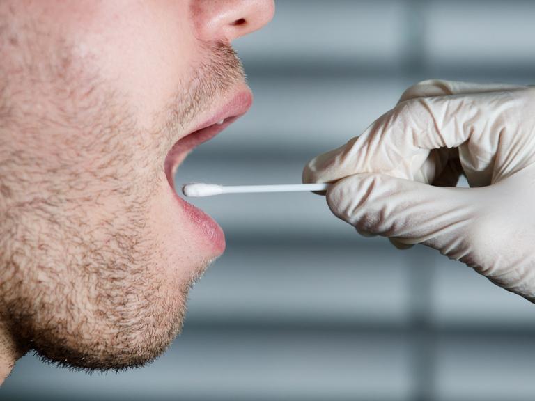 Ein geöffneter Mund und eine Hand mit weißem Plastikhandschuh, die mit einem Wattestäbchen eine Speichelprobe abnimmt. 