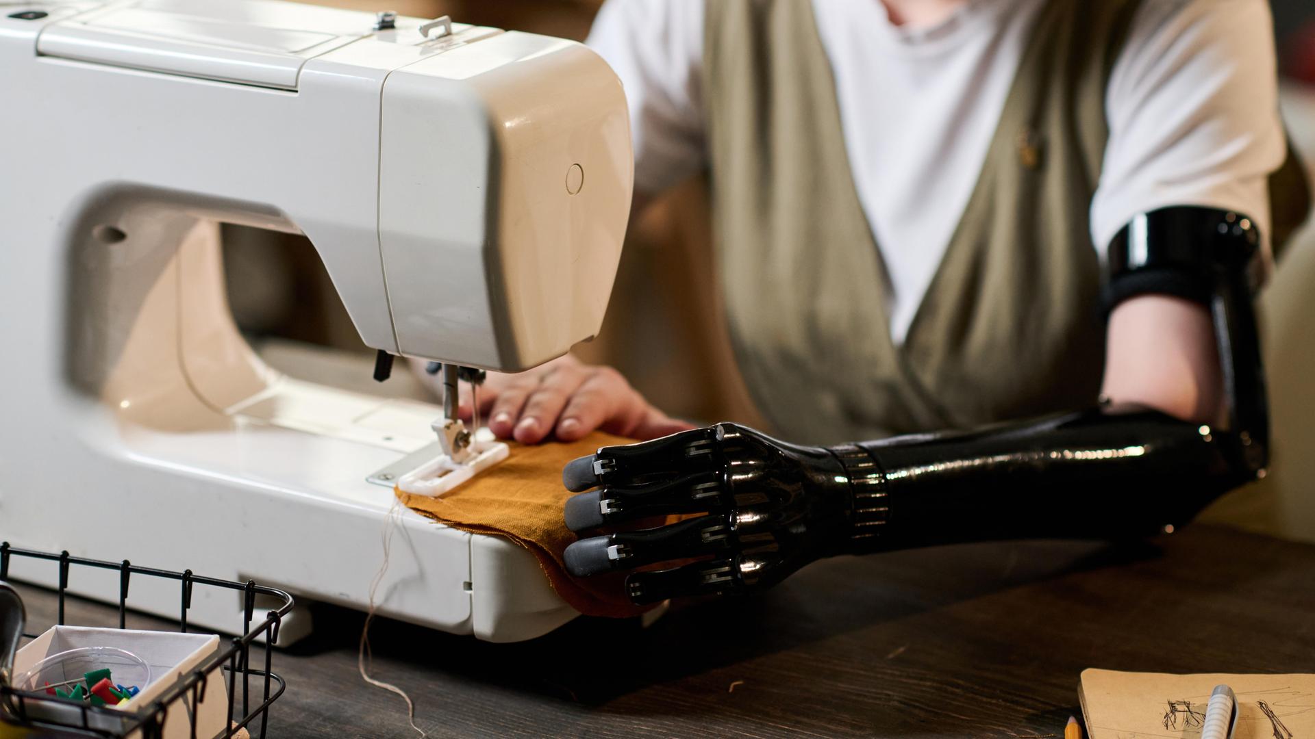 Eine junge Frau mit einer Unterarmprothese arbeitet an einer Nähmaschine. (Symbolbild)