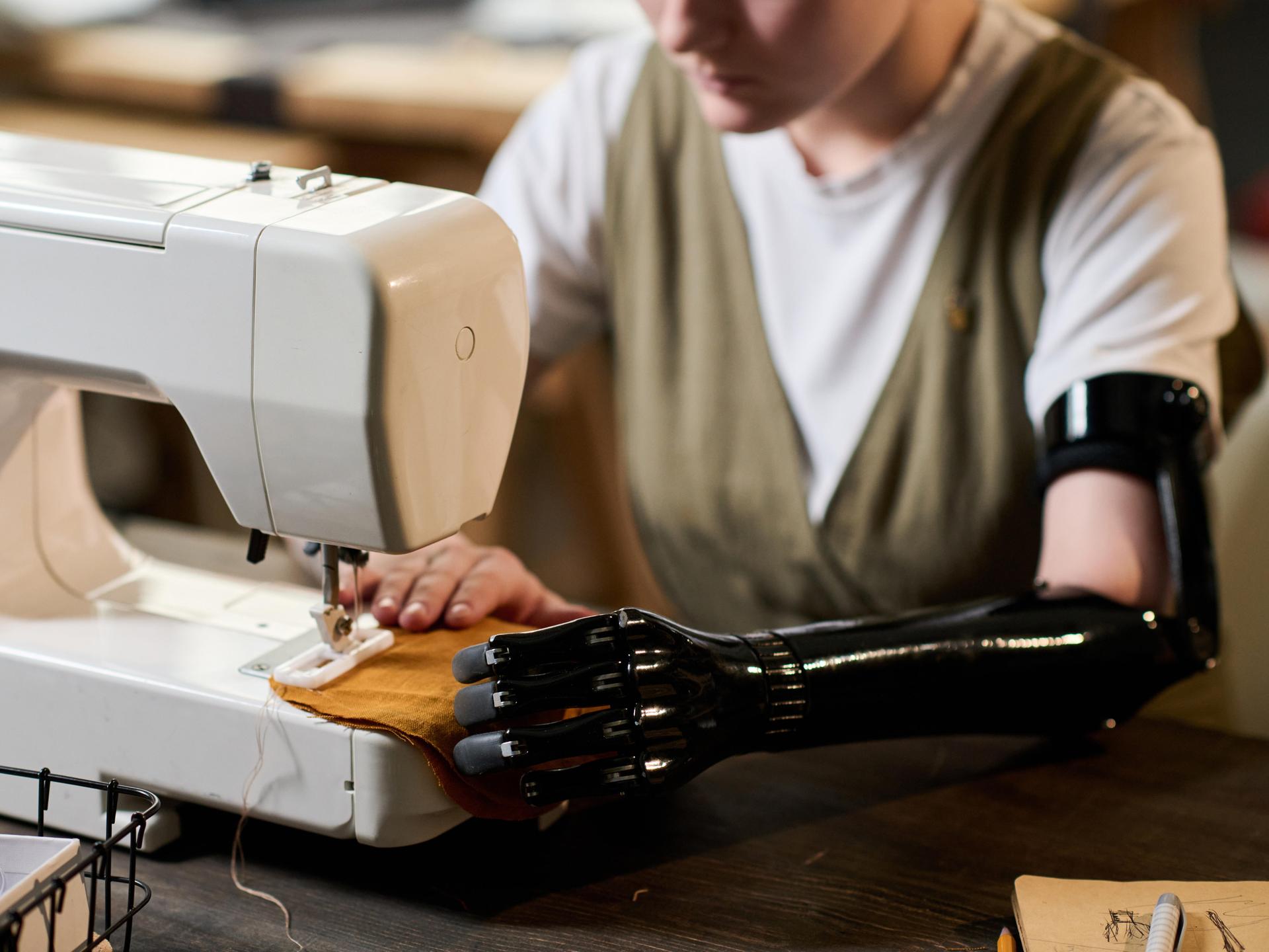 Eine junge Frau mit einer Unterarmprothese arbeitet an einer Nähmaschine.