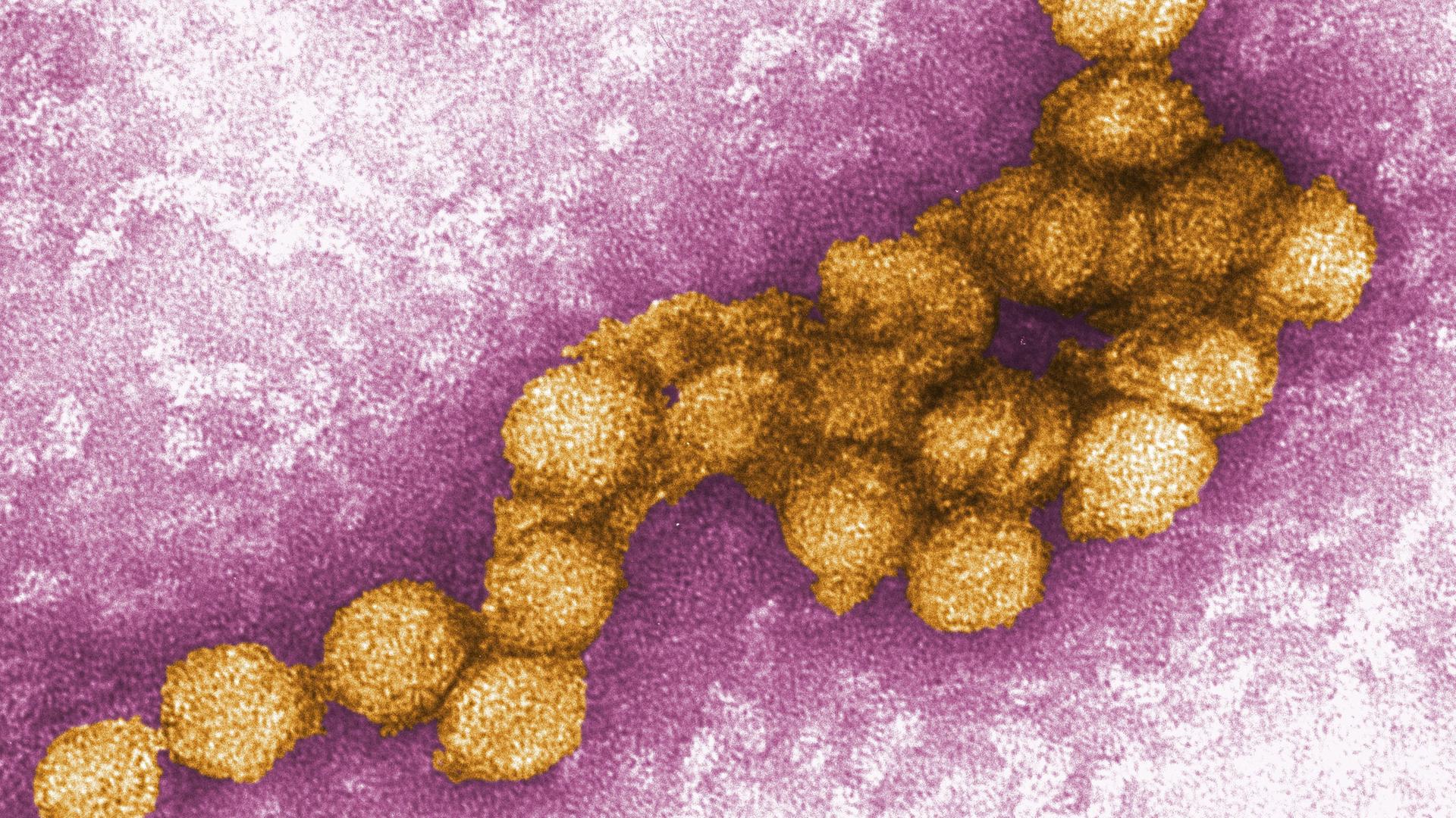 Aufnahme des West-Nil-Virus. 