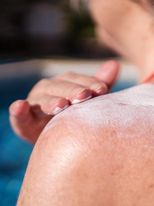 Eine Frau im Bikini cremt sich ihre Schulter mit Sonnenmilch ein. 