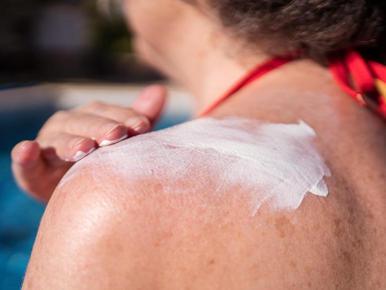 Eine Frau im Bikini cremt sich ihre Schulter mit Sonnenmilch ein. 