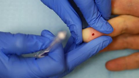 Während eines Tests wird ein Blutstropfen von einem Finger abgenommen. Während eines Tests wird ein Blutstropfen von einem Finger abgenommen.