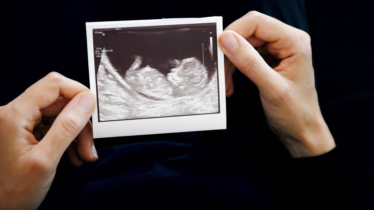 Eine Frau hält das Ultraschallbild eines ungeborenen Kindes in den Händen.