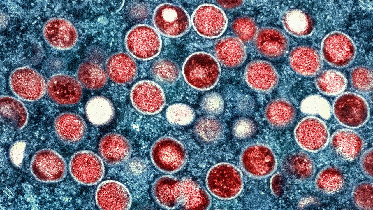 Mpox-Viren unter dem Mikroskop.