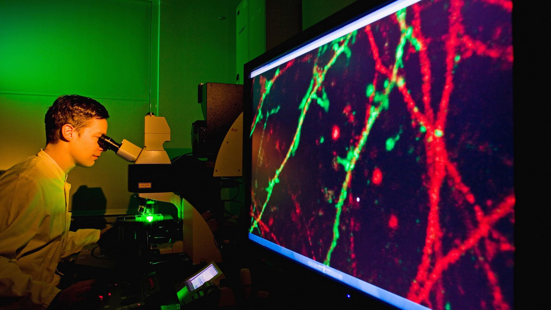 Wissenschaftler untersucht Nervenzellen an einem Fluoreszenzmikroskop. Neurowissenschaftler forschen hier an neurologischen Leiden, wie Alzheimer oder Schlaganfall. Wissenschaftler untersucht Nervenzellen an einem Fluoreszenzmikroskop. Neurowissenschaftler forschen hier an neurologischen Leiden, wie Alzheimer oder Schlaganfall.