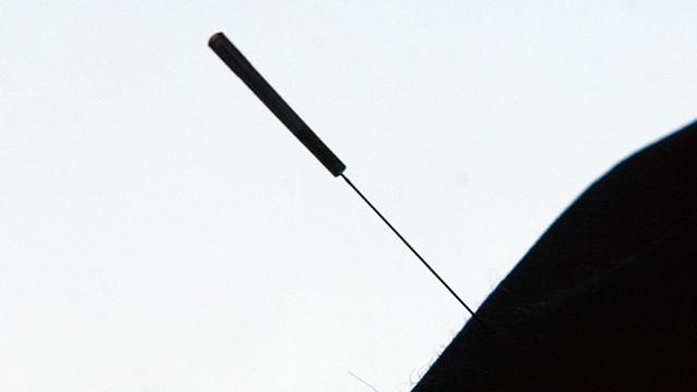 Eine Akupunkturnadel sticht in einen menschlichen Körper.
