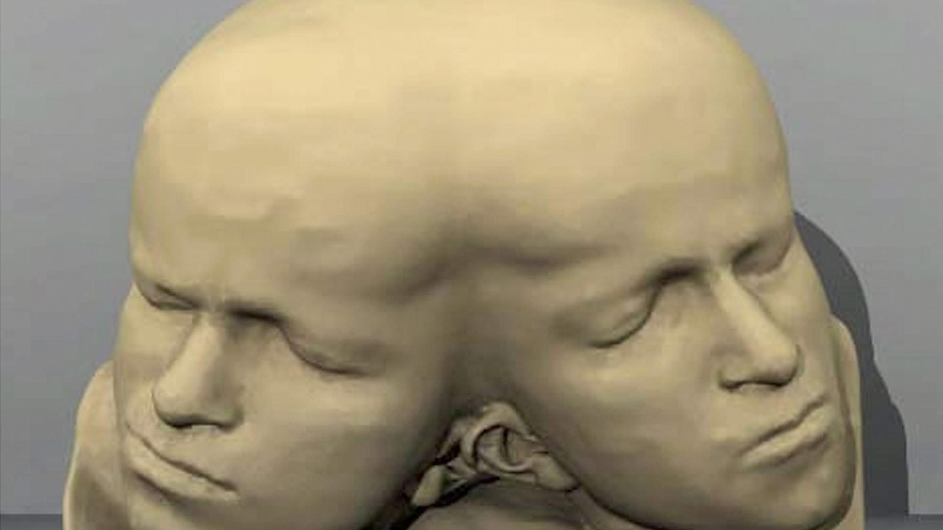 Plastik zweier zusammengewachsener Schädel mit unterschiedlichen Profilen.