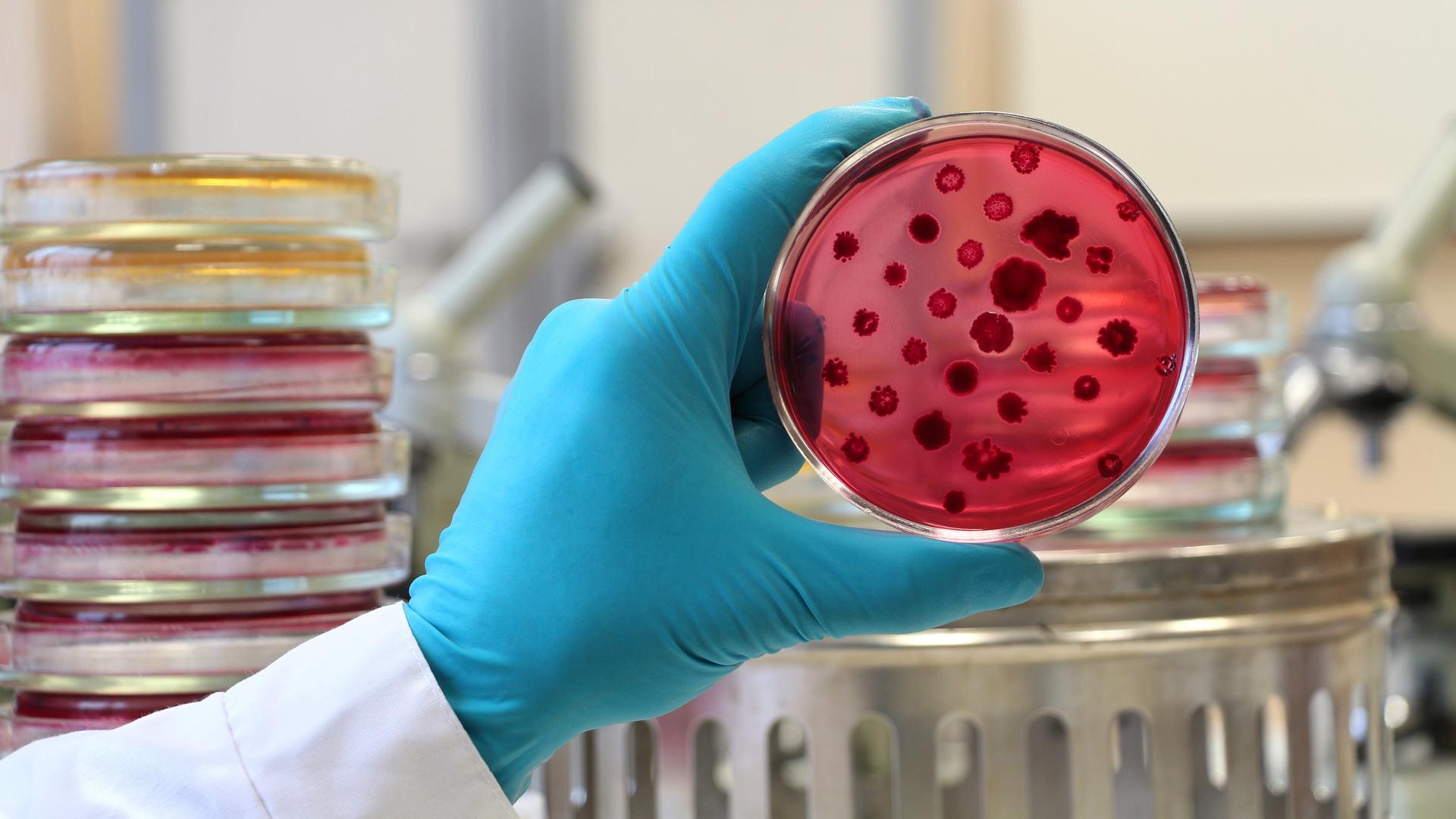 Die Hand eines Wissenschaftlers in einem weißen Laborkittel und einem blauen Handschuh hält eine geöffnete rote Petrischale die mit Bakterienkolonien bedeckt ist.