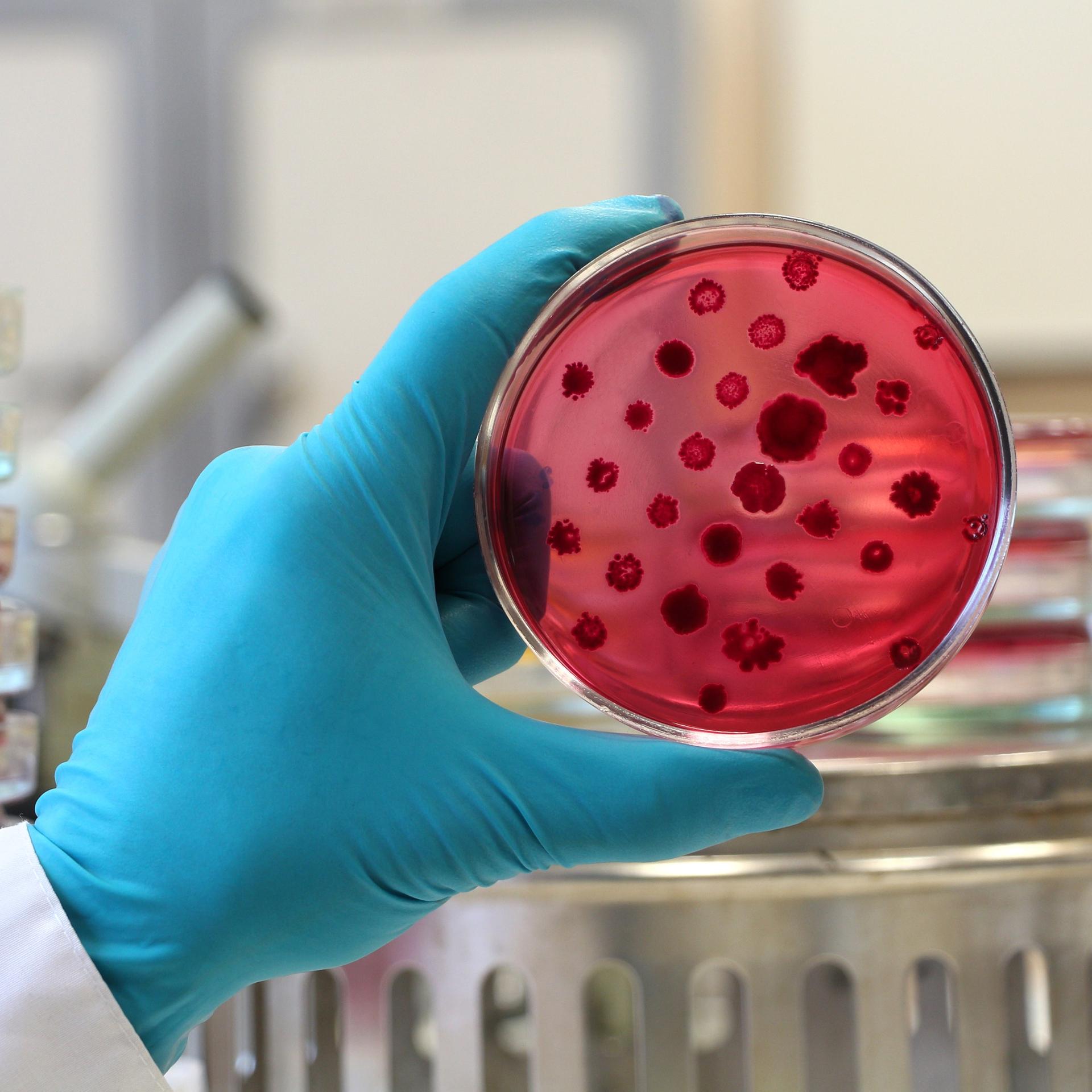 Designer-Antibiotika - Mit KI gegen resistente Keime