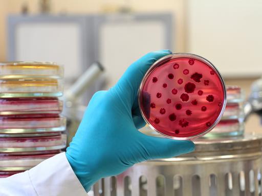 Die Hand eines Wissenschaftlers in einem weißen Laborkittel und einem blauen Handschuh hält eine geöffnete rote Petrischale die mit Bakterienkolonien bedeckt ist.