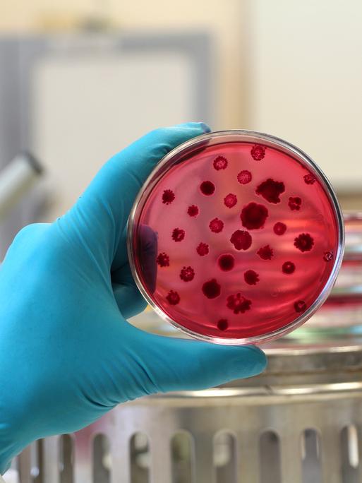 Die Hand eines Wissenschaftlers in einem weißen Laborkittel und einem blauen Handschuh hält eine geöffnete rote Petrischale die mit Bakterienkolonien bedeckt ist.