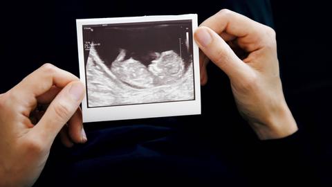 Zwei Frauenhände halten das Ultraschallbild eines ungeborenen Kindes.