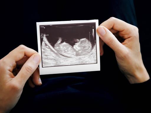 Zwei Frauenhände halten das Ultraschallbild eines ungeborenen Kindes.