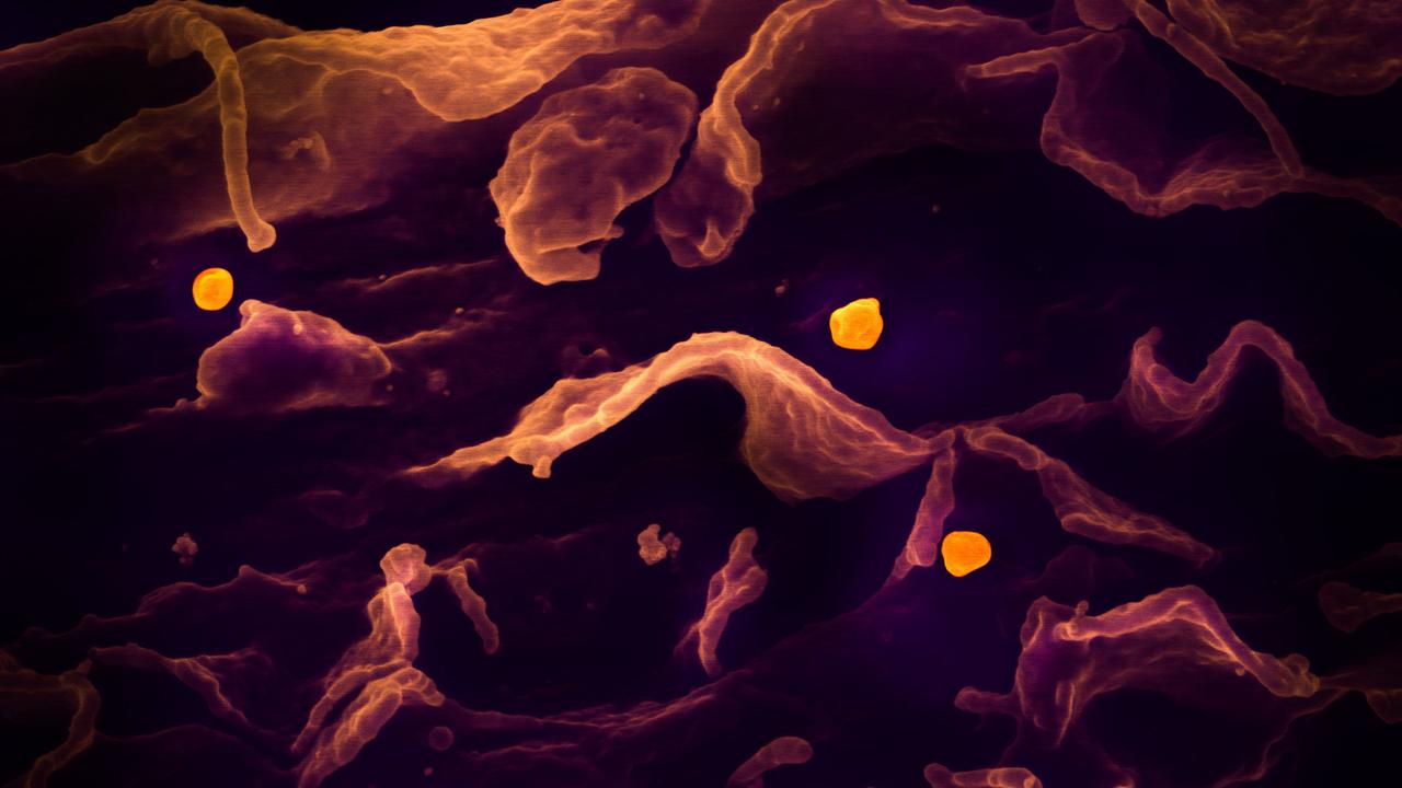 Eine rasterelektronenmikroskopische Aufnahme zeigt das Nipah-Virus (gelb), das sich von der Oberfläche einer Zelle löst.