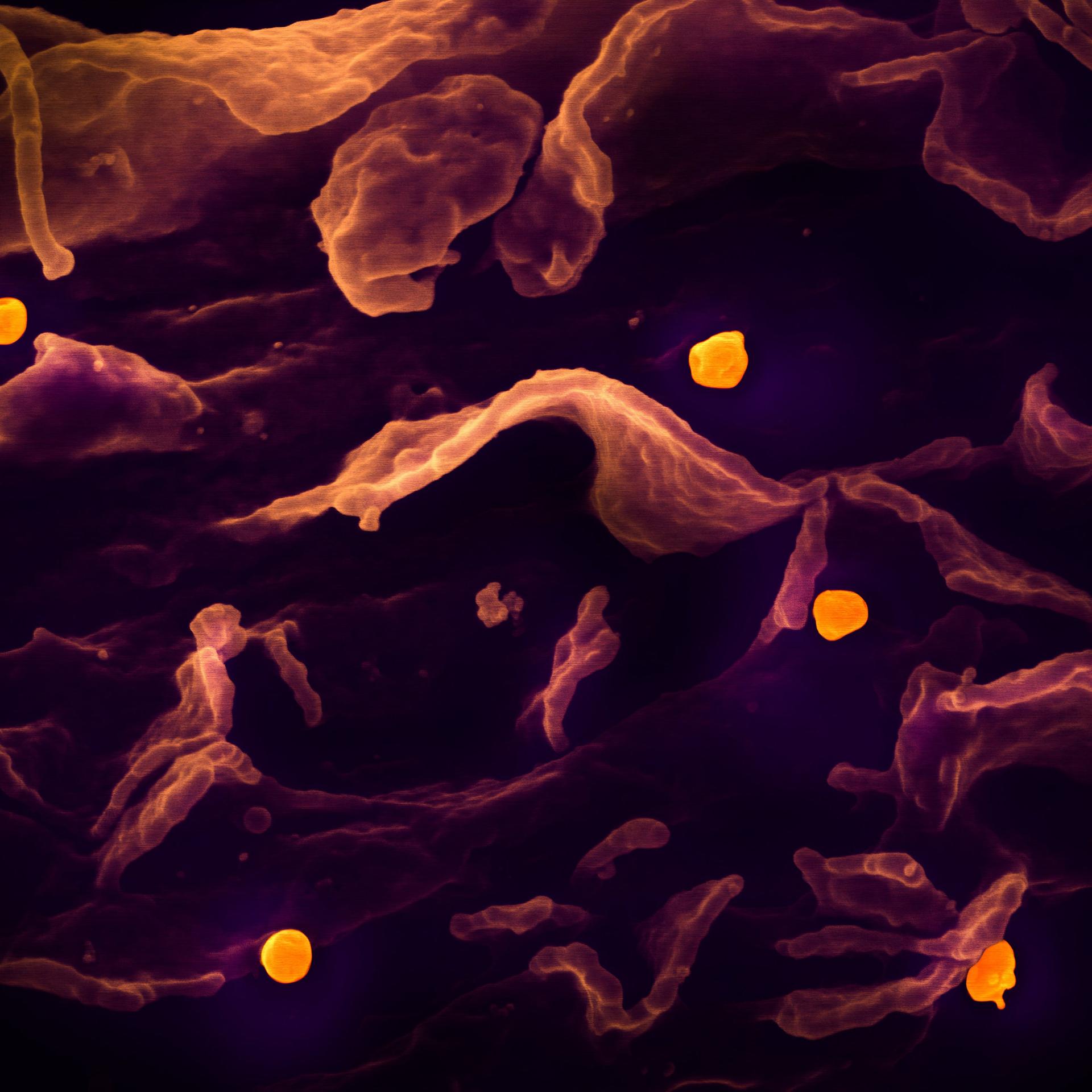 Eine rasterelektronenmikroskopische Aufnahme zeigt das Nipah-Virus (gelb), das sich von der Oberfläche einer Zelle löst.