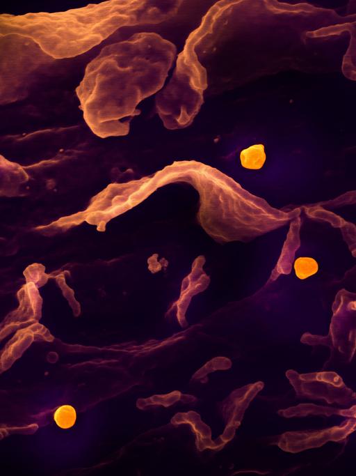 Eine rasterelektronenmikroskopische Aufnahme zeigt das Nipah-Virus (gelb), das sich von der Oberfläche einer Zelle löst.