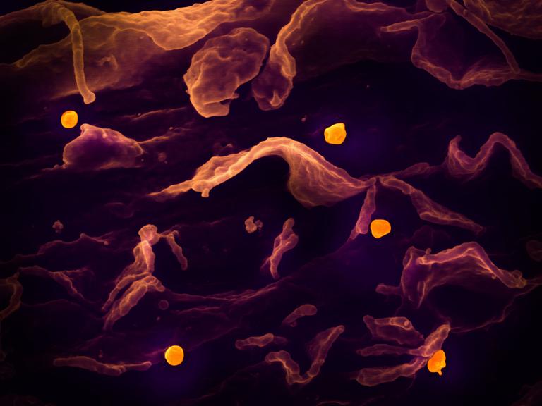 Eine rasterelektronenmikroskopische Aufnahme zeigt das Nipah-Virus (gelb), das sich von der Oberfläche einer Zelle löst.