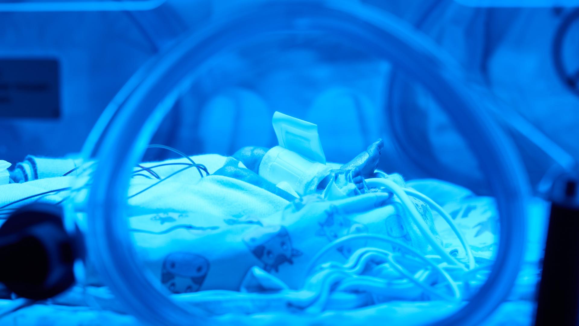 Ein Frühchen liegt unter blauem Licht in einem Inkubator in der Klinik für Kinder- und Jugendmedizin am Uniklinikum Dortmund. 