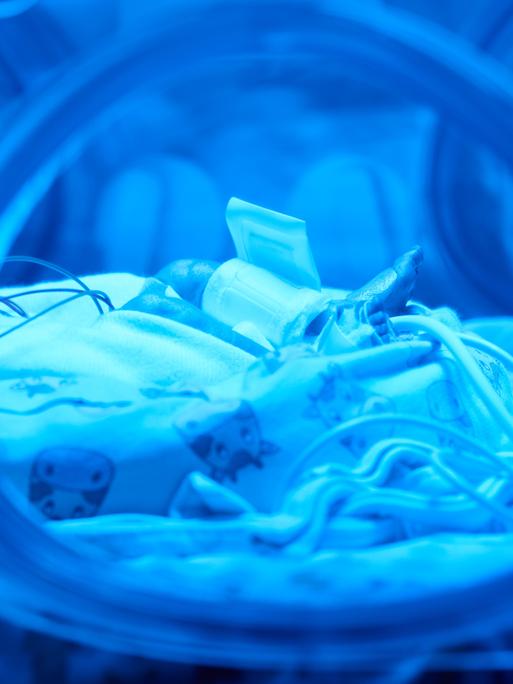 Ein Frühchen liegt unter blauem Licht in einem Inkubator in der Klinik für Kinder- und Jugendmedizin am Uniklinikum Dortmund. 