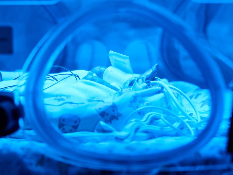 Ein Frühchen liegt unter blauem Licht in einem Inkubator in der Klinik für Kinder- und Jugendmedizin am Uniklinikum Dortmund. 