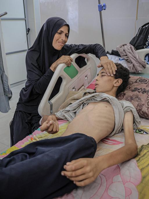 Ein stark abgemagerter Jugendlicher liegt im Al-Schifa-Krankenhaus in Gaza-Stadt in einem Krankenbett und wartet auf Behandlung. Seine Mutter kümmert sich um ihn.