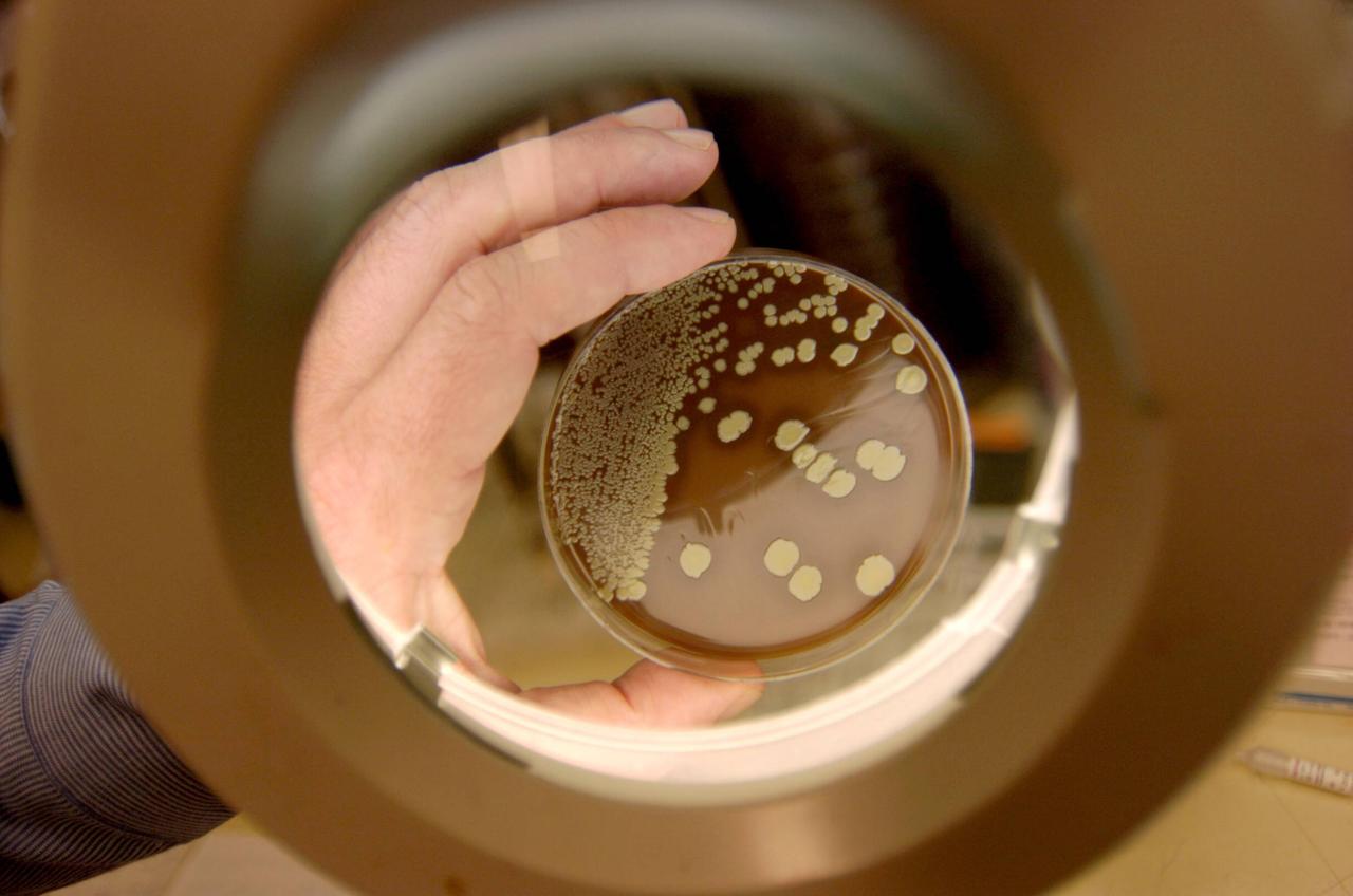 Eine Petrischale mit den multiresistenten Bakterien Staphylococcus Aureus unter einer Lupe.