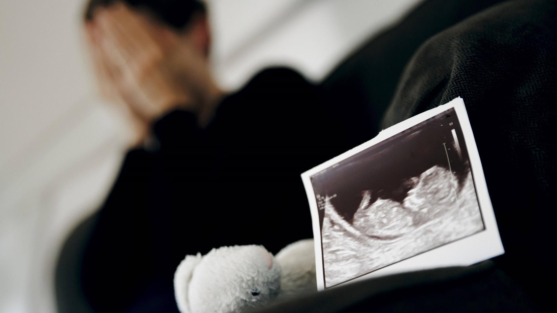 Symbolfoto: Gestellte Aufnahme zum Thema Fehlgeburt. Das Ultraschallbild eines ungeborenen Kindes steht neben einem Kuscheltier waehrend eine Frau im Hintergrund ihr Gesicht in ihren Haenden verbirgt. 