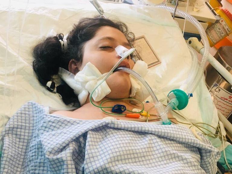 Ein Bild von Mahsa Amini, 22. Sie liegt in einem Krankenhausbett und wird künstlich beatmet.