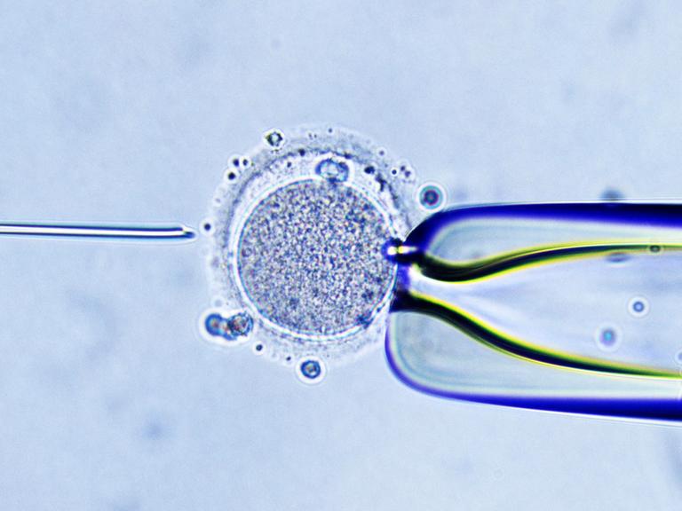 Eine Mikroskopaufnahme der Injektion von einem Spermium in eine Eizelle.