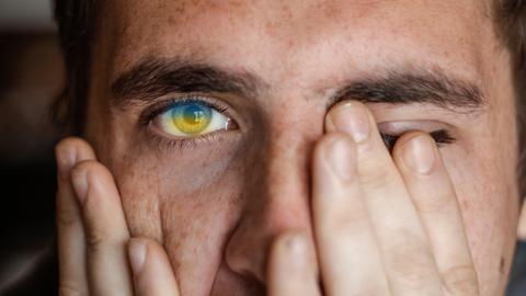 Ein junger Mann vergräbt sein Gesicht in seinen Händen. Im sichtbaren Auge sind die Farben der ukrainischen Flagge erkennbar.