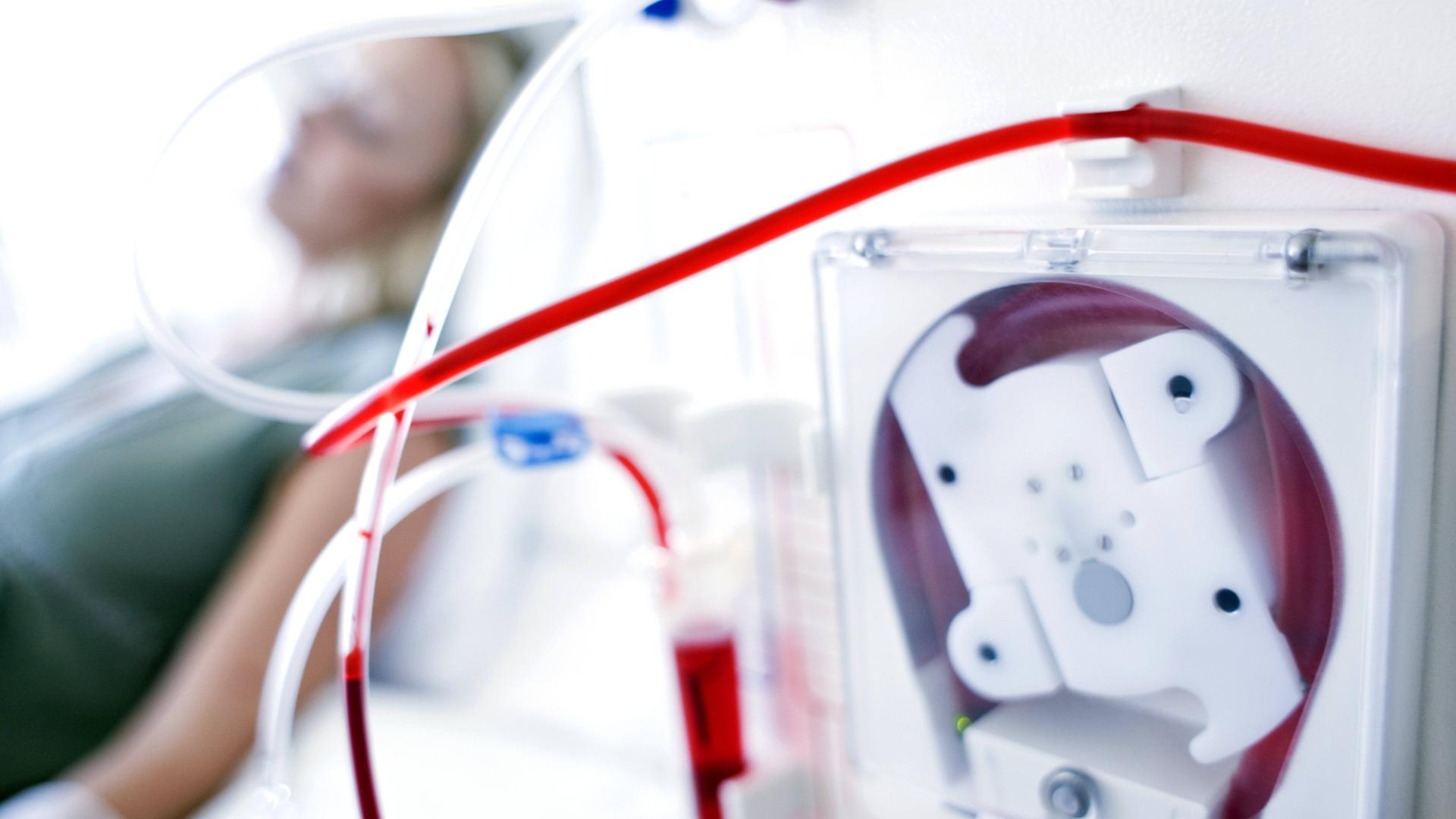 Eine Frau ist an eine Dialysemaschine angeschlossen. Schläuche und Maschine im Vordergrund sind scharf, die Frau im Hintergrund unscharf.