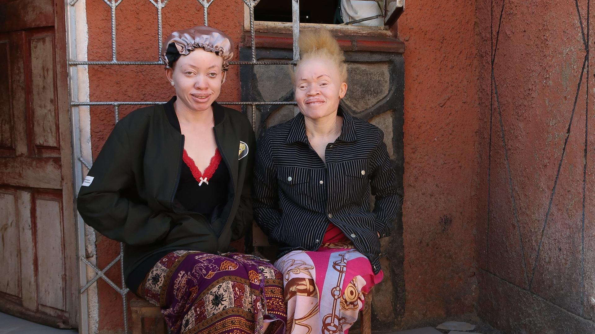 Zwei junge afrikanische Frauen mit für Albinismus charakteristisch heller Hautfarbe sitzen vor einem Haus und lachen in die Kamera.