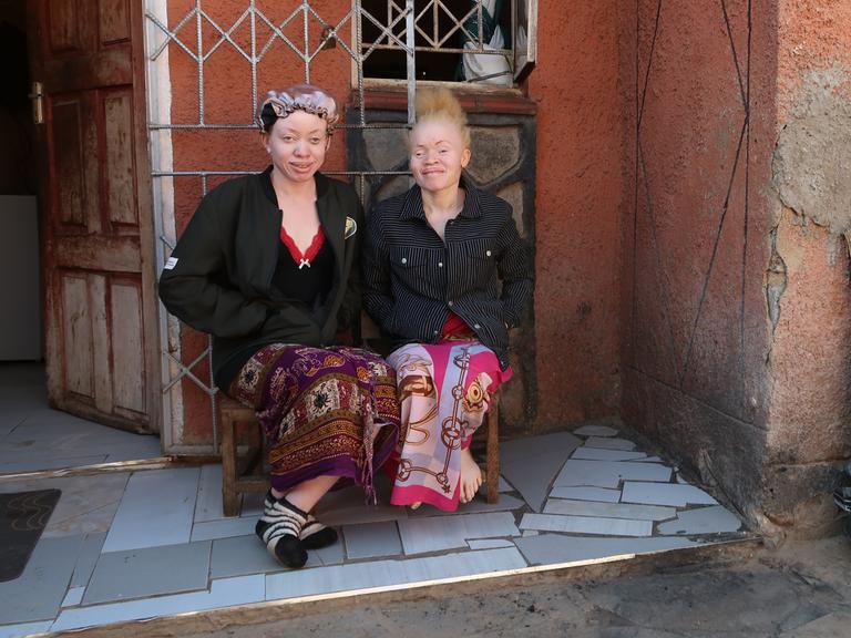 Zwei junge afrikanische Frauen mit für Albinismus charakteristisch heller Hautfarbe sitzen vor einem Haus und lachen in die Kamera.