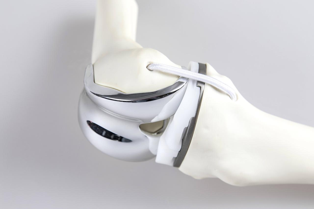 Knieprothese, Knieendoprothese oder Kniegelenksprothese, an einem Knochenmodell, künstliches Kniegelenk,Knee prosthesis  Or  to a Bone model artificial Knee joint  