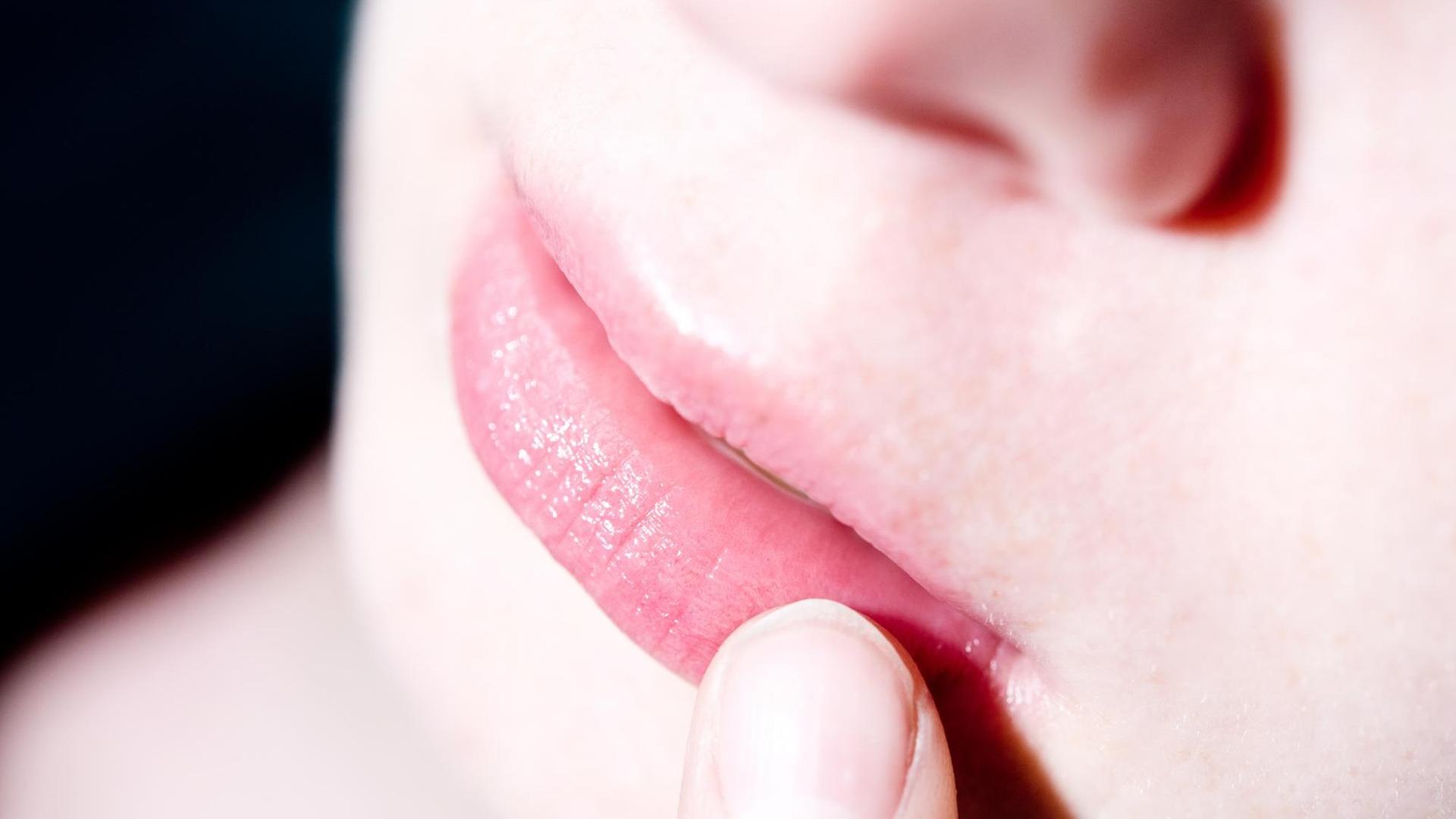 ILLUSTRATION - Eine Frau befühlt mit einem Finger eine juckende und schmerzende Stelle auf ihrer Lippe. Foto: Franziska Gabbert | Verwendung weltweit