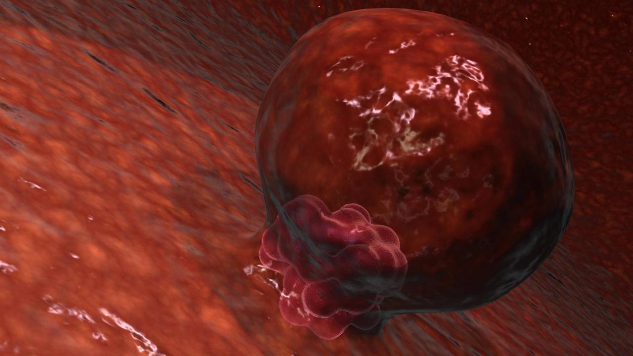 Ein Blastozyst beginnt mit der Einnistung in die Gebärmutterwand. (Computerillustration)