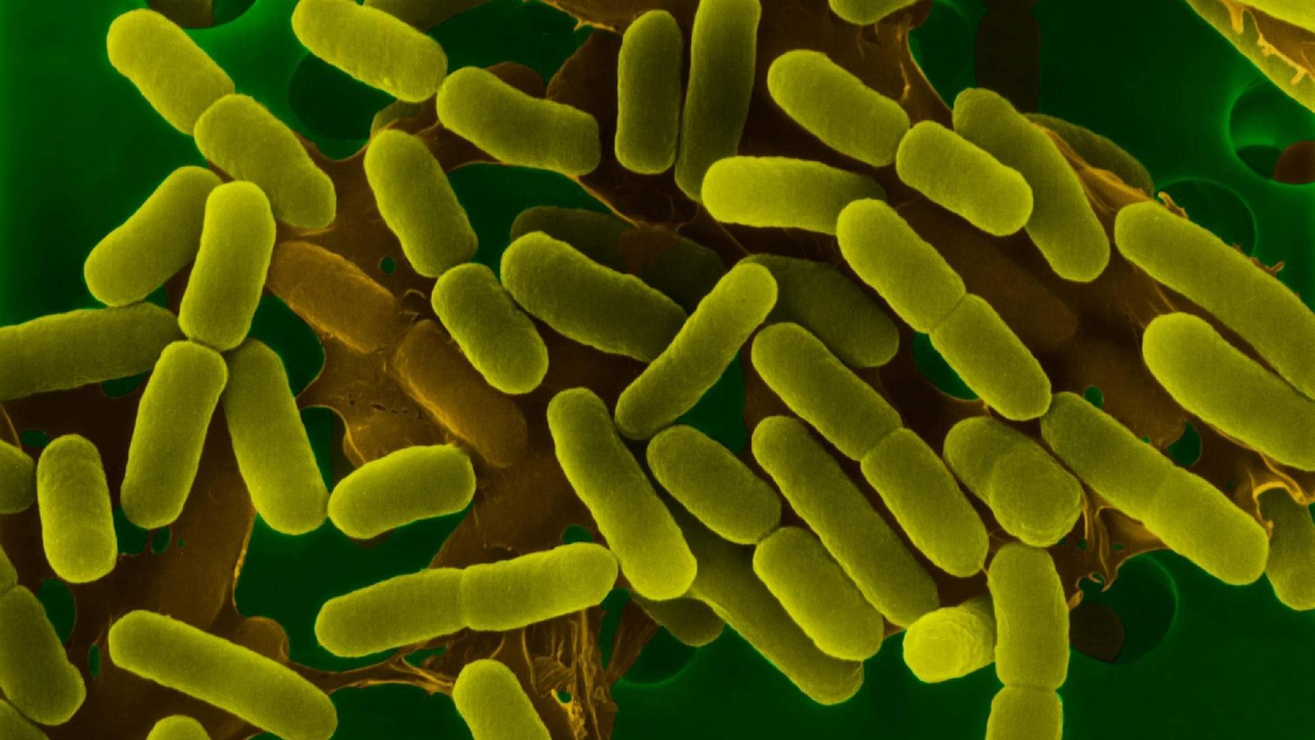 Darmbakterien Escherichia coli unter dem Elektronenmikroskop, grün eingefärbte Aufnahme