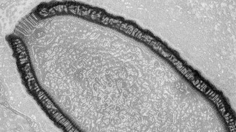 Eine Mikroskopaufnahme zeigt einen Pithovirus.