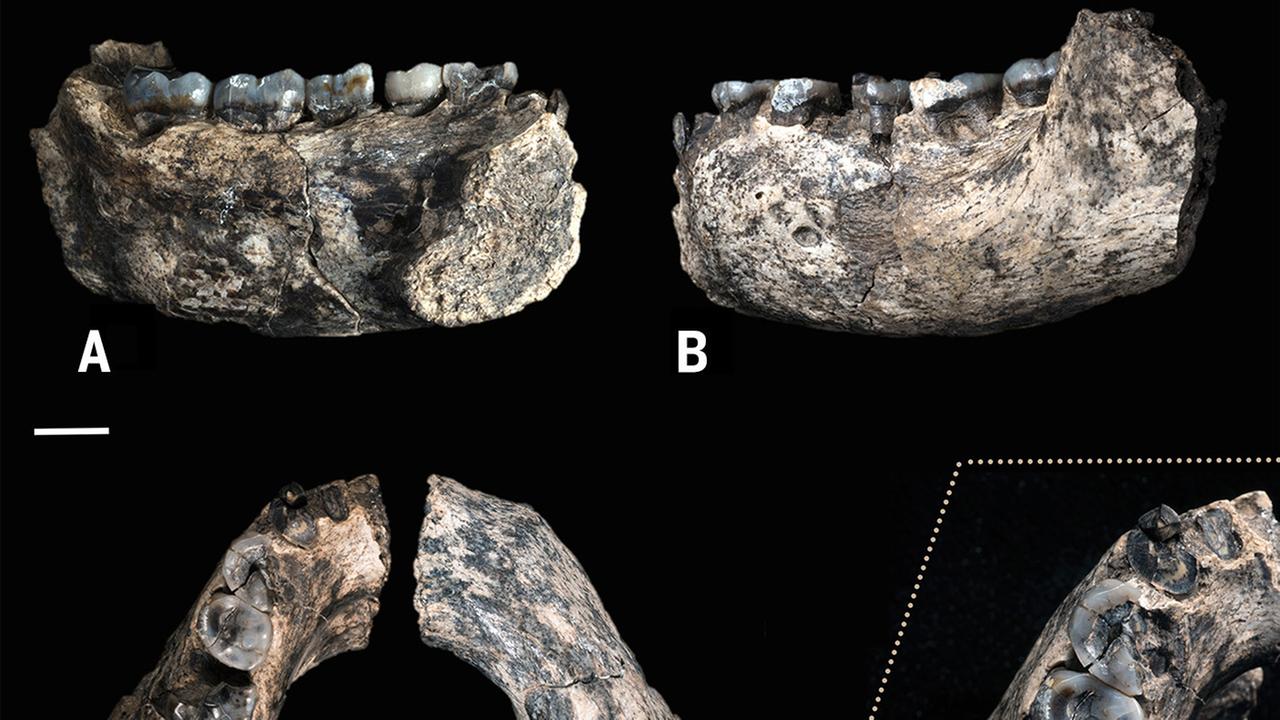 Das Fundstück aus Äthiopien: eine linke Unterkieferhälfte mit fünf Zähnen.