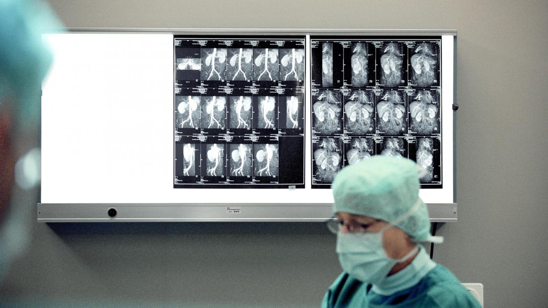 Ein Arzt im Universitätsspital Basel, Schweiz entnimmt einer einer Spenderin eine Niere. Im Hintergrund sind Röntgenbilder des zu entnehmenden Organs zu sehen.