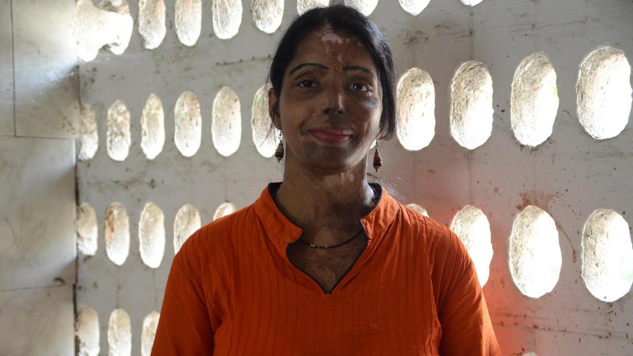 Mohini Atri ist Überlebende eines Säuerangriffs; Heute arbeitet sie für die Frauenkommission und hilft anderen Frauen in Not.